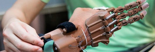3D Printed Prosthetic Hands